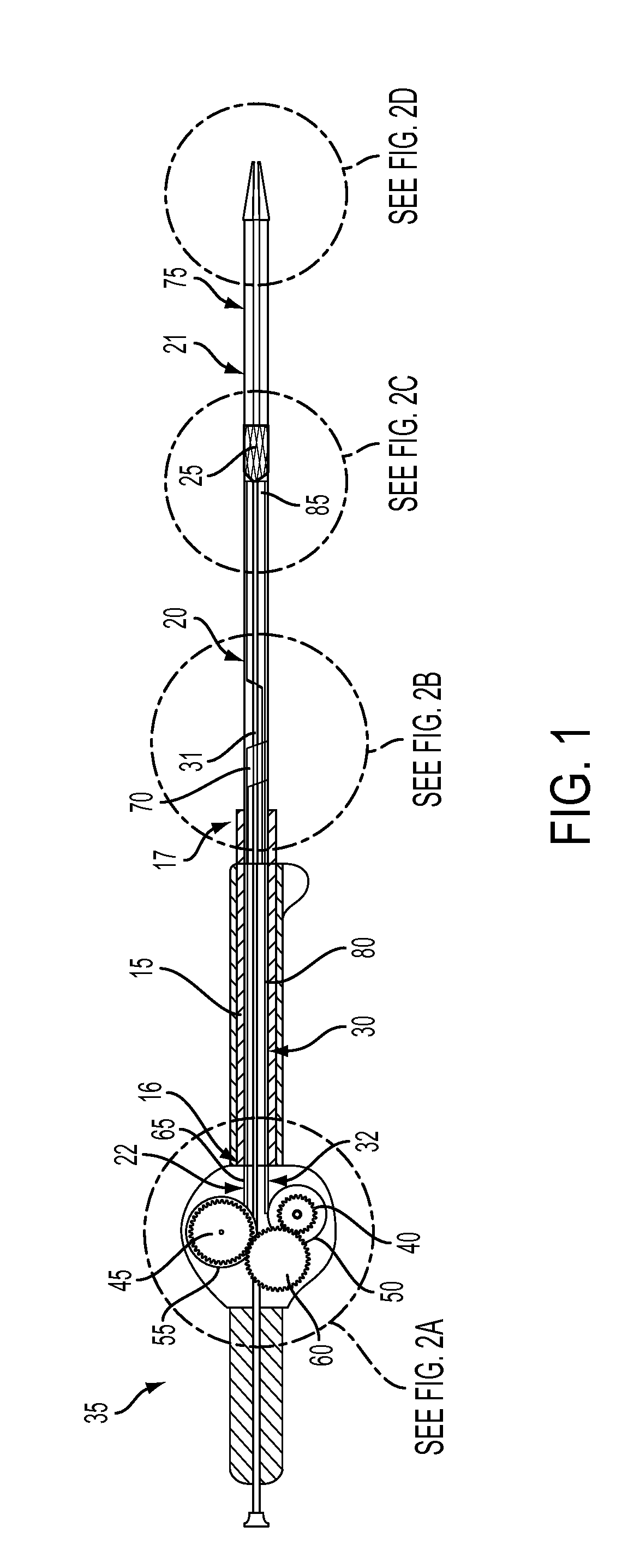 Stent Deployment Device and Methods for Use