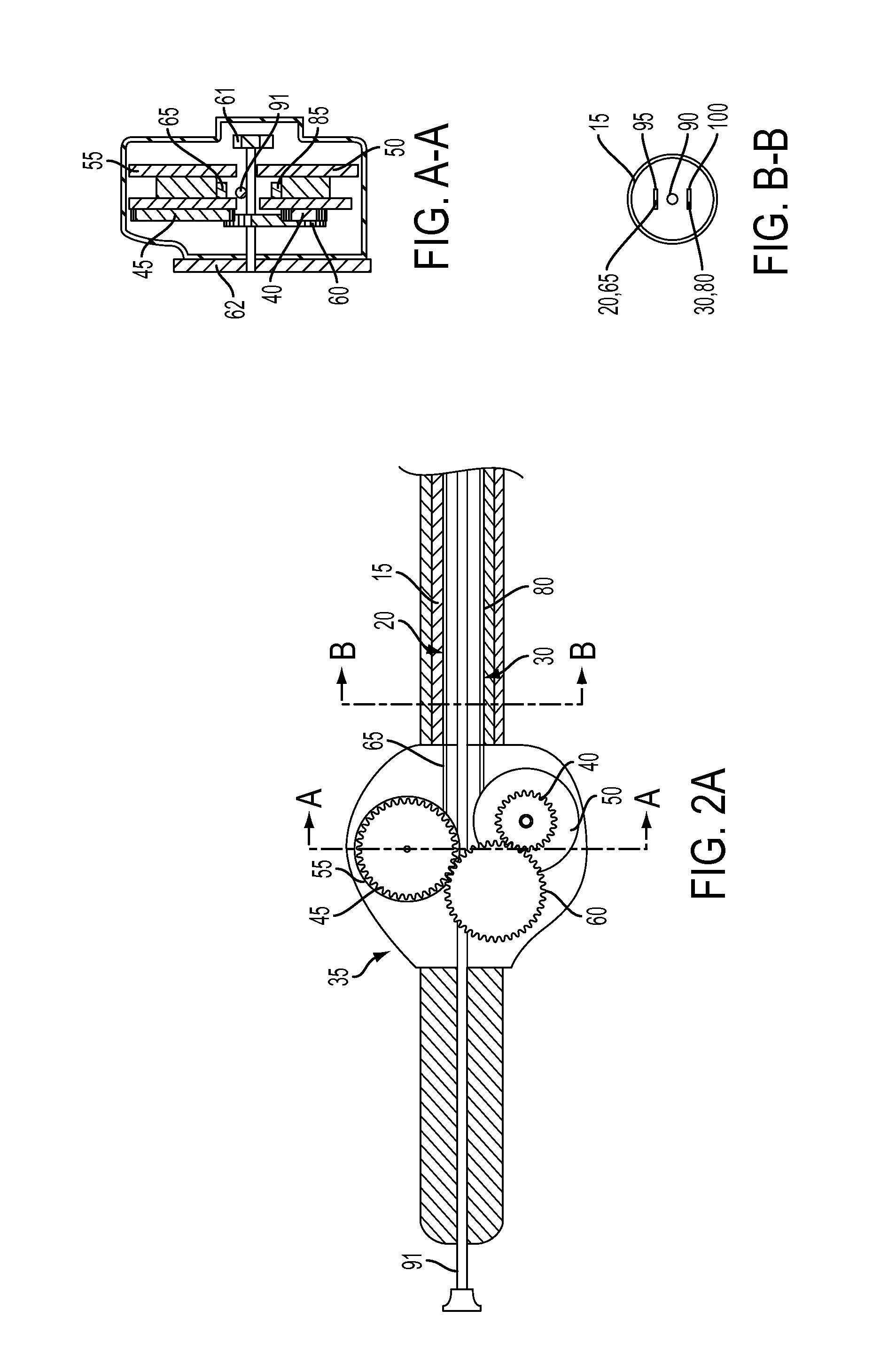 Stent Deployment Device and Methods for Use