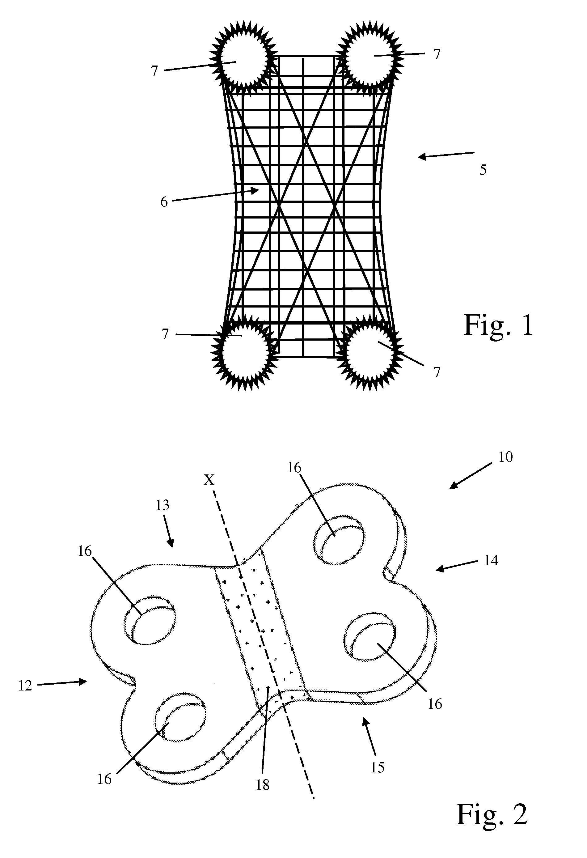 Methods and instrumentation for orthopedic surgery