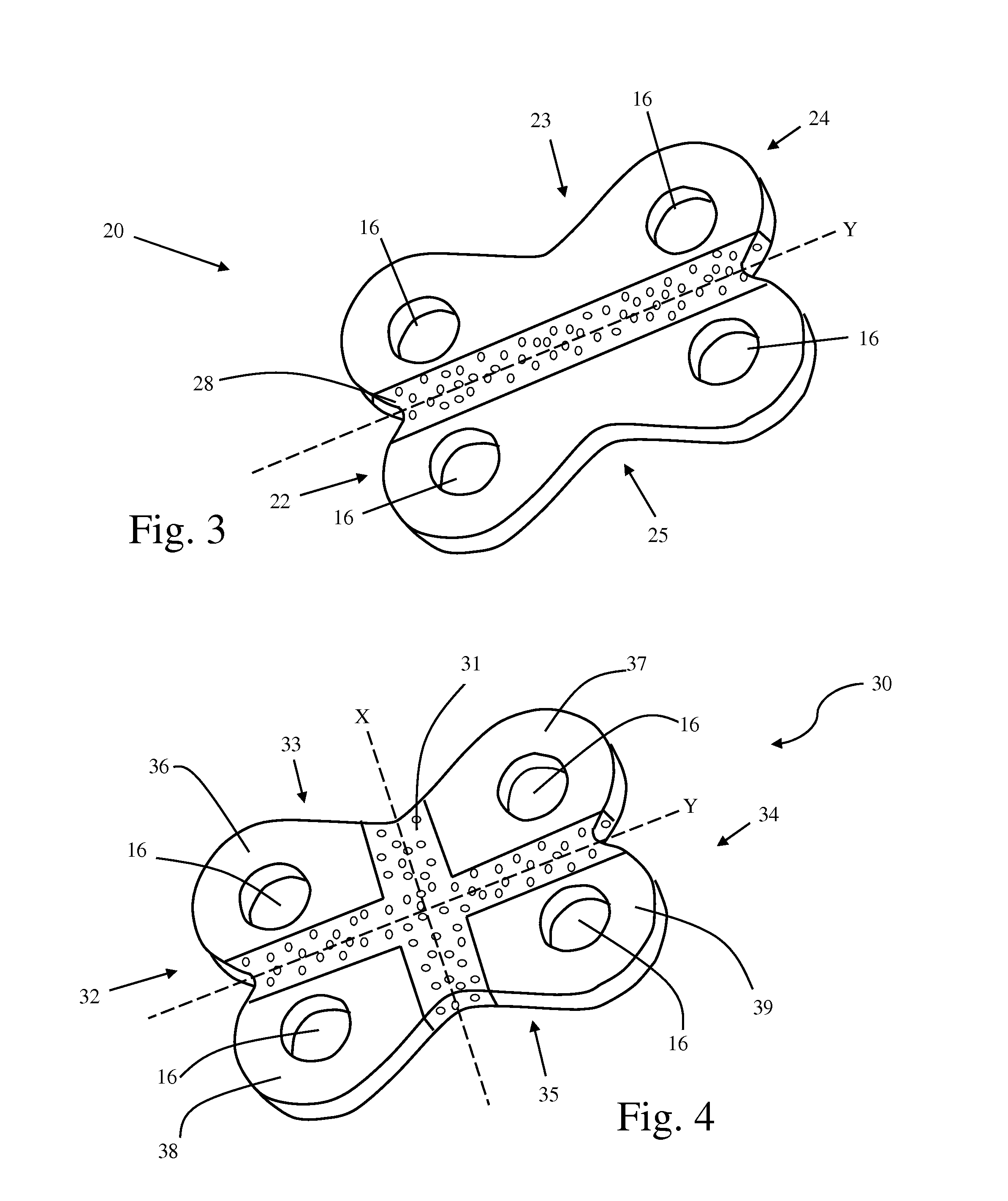 Methods and instrumentation for orthopedic surgery