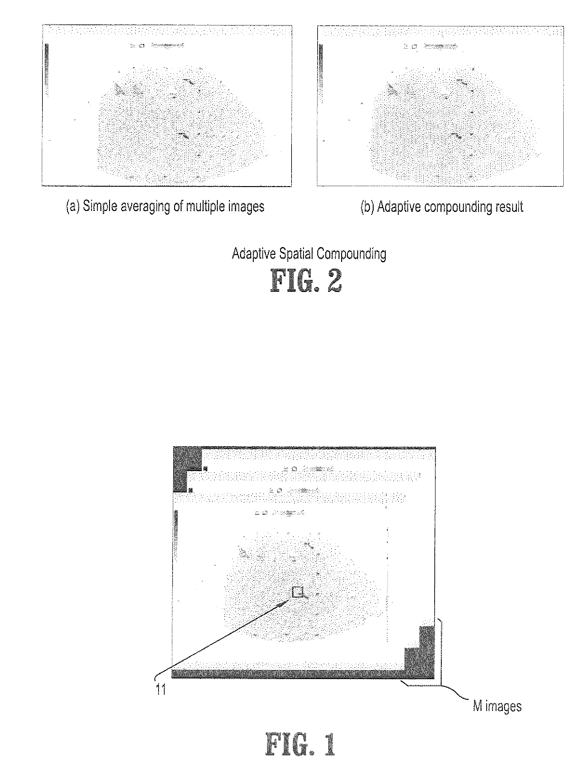 System and Method For Adaptive Spatial Compounding For Ultrasound Imaging