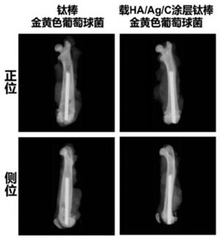 Titanium alloy implant with effects of resisting infection and promoting bone formation and preparation method thereof