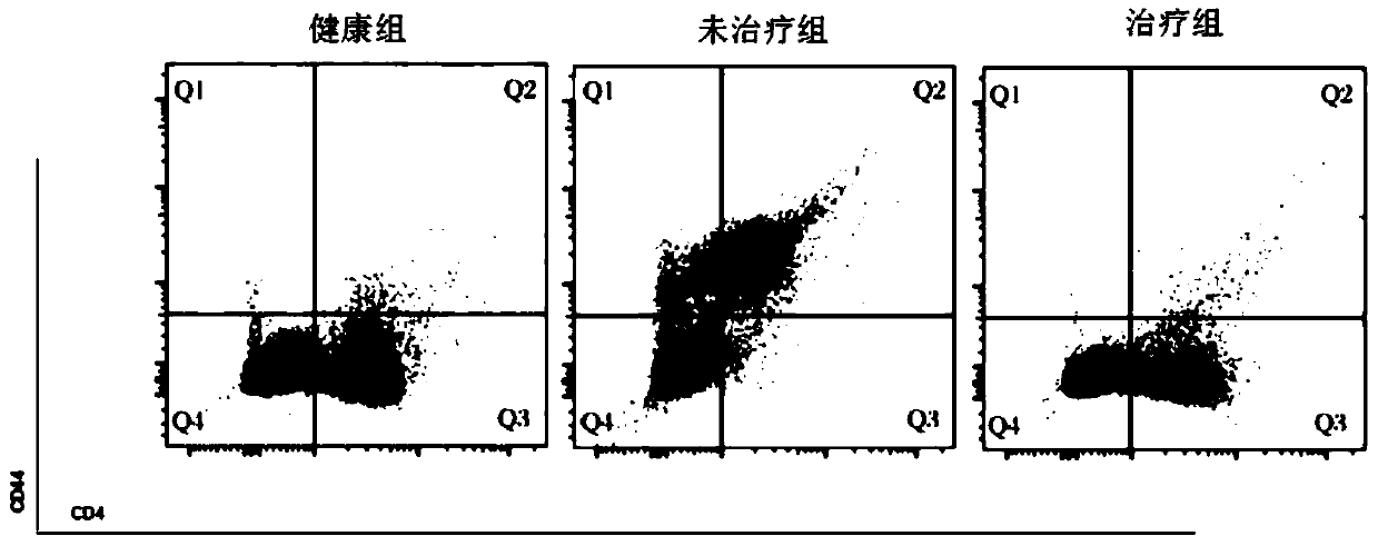 Vector containing double-target chimeric antigen receptor gene, CAR-T cell and application of CAR-T cell