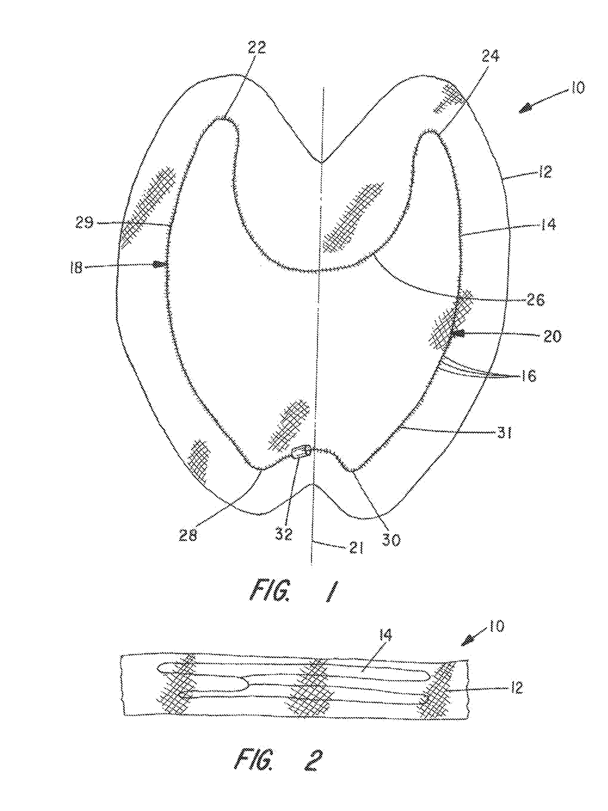 Apparatus and method for pelvic floor repair in the human female