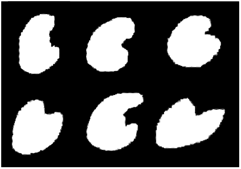 Method for segmenting renal cortex images