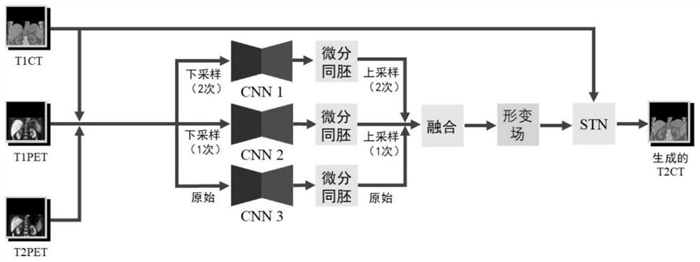 Delayed CT image generation method based on deep learning algorithm