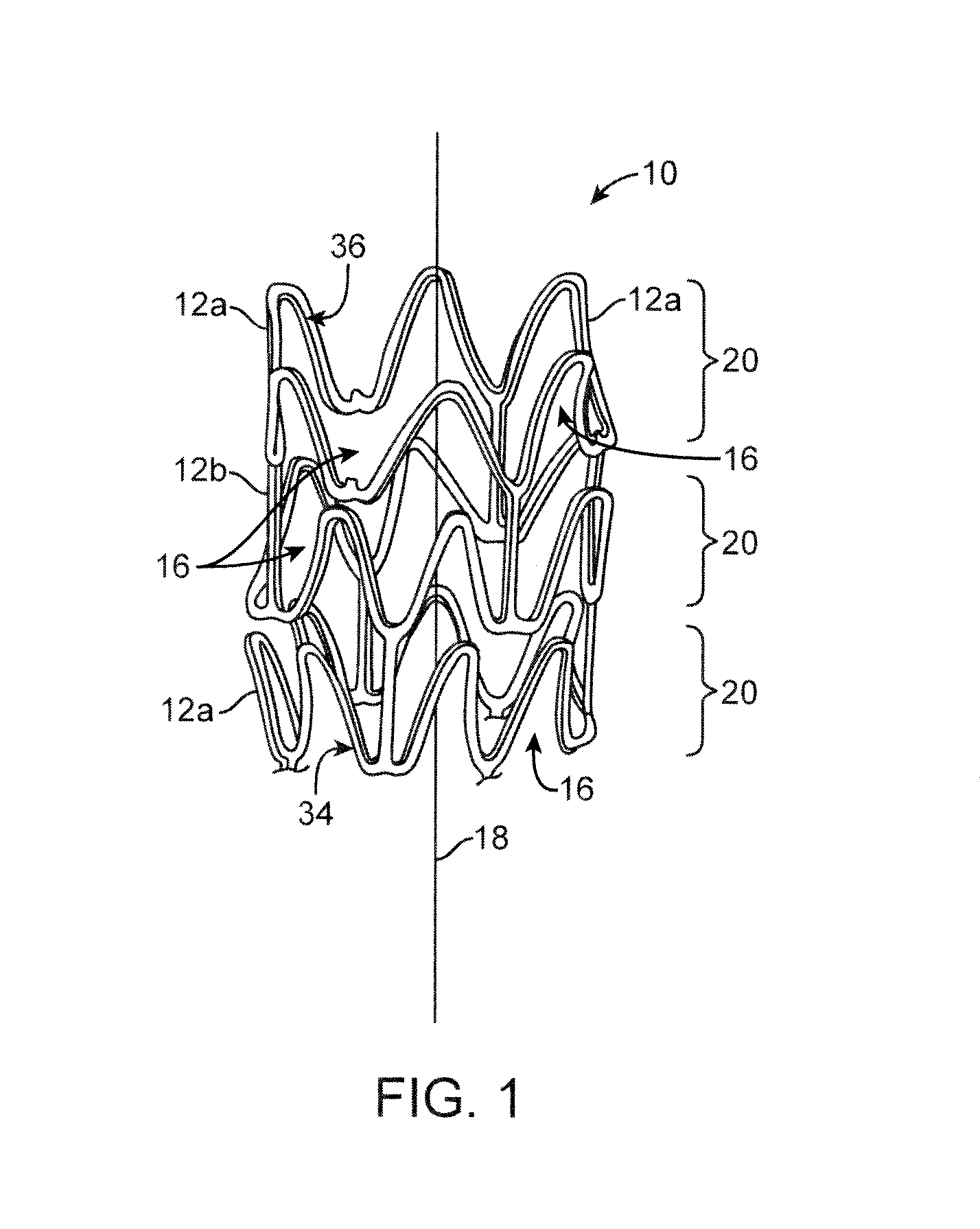 Implantable Prosthesis With Depot Retention Feature