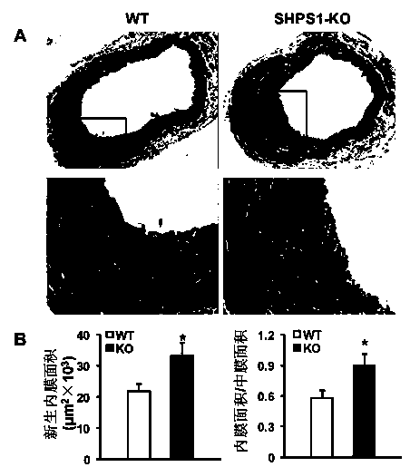 Functions and application of SHPS1 in treatment of post-vascular injury restenosis