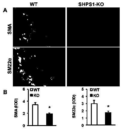 Functions and application of SHPS1 in treatment of post-vascular injury restenosis