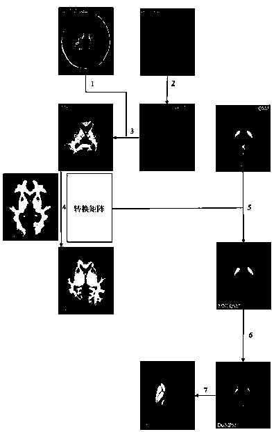 A method for constructing a probability atlas of human gray matter nuclei based on quantitative magnetic susceptibility imaging