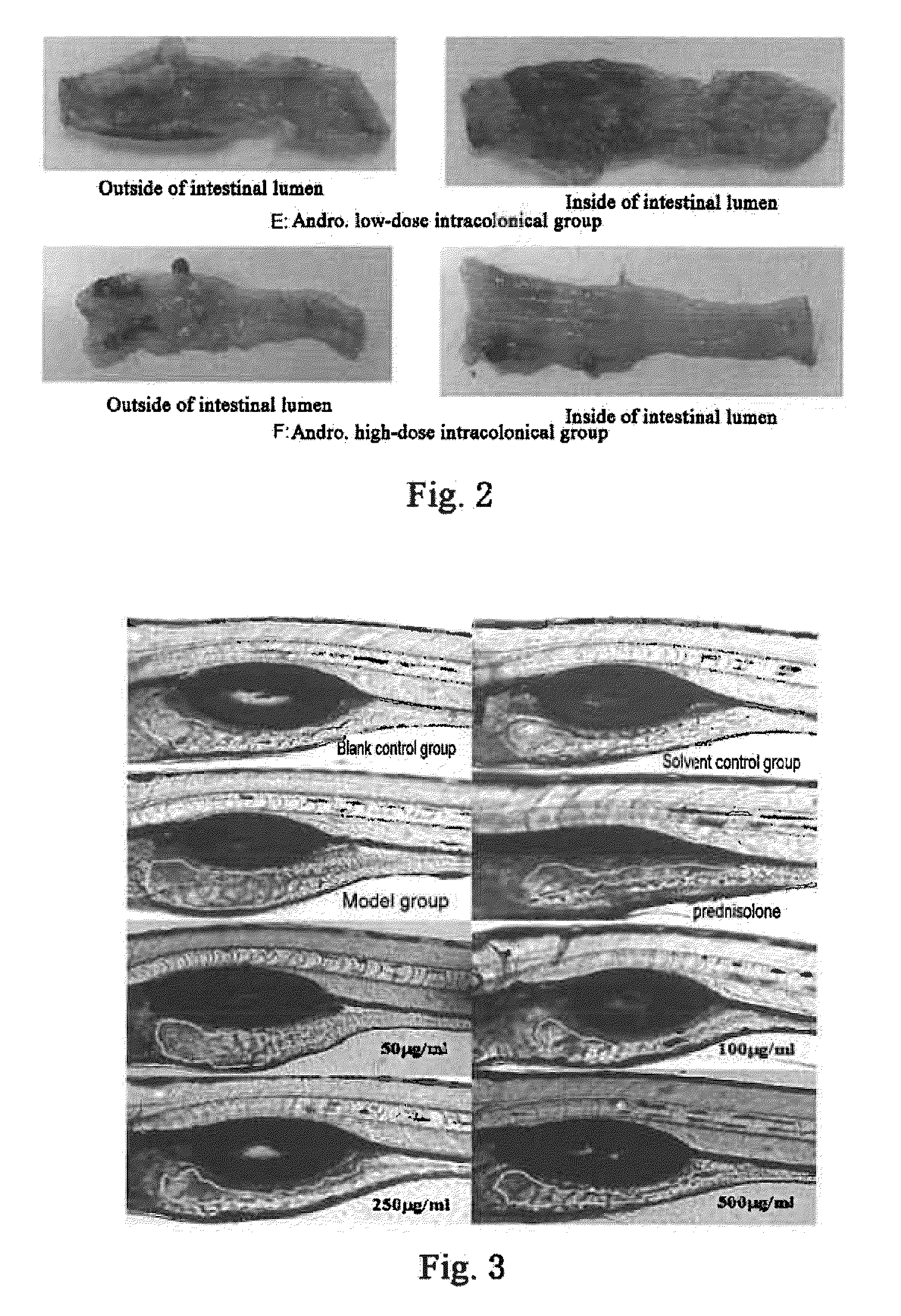 Application of andrographolide in the preparation of a pharmaceutical for treatment of inflammatory bowel disease, andrographolide enteric targeting micropellet, and method for preparation thereof