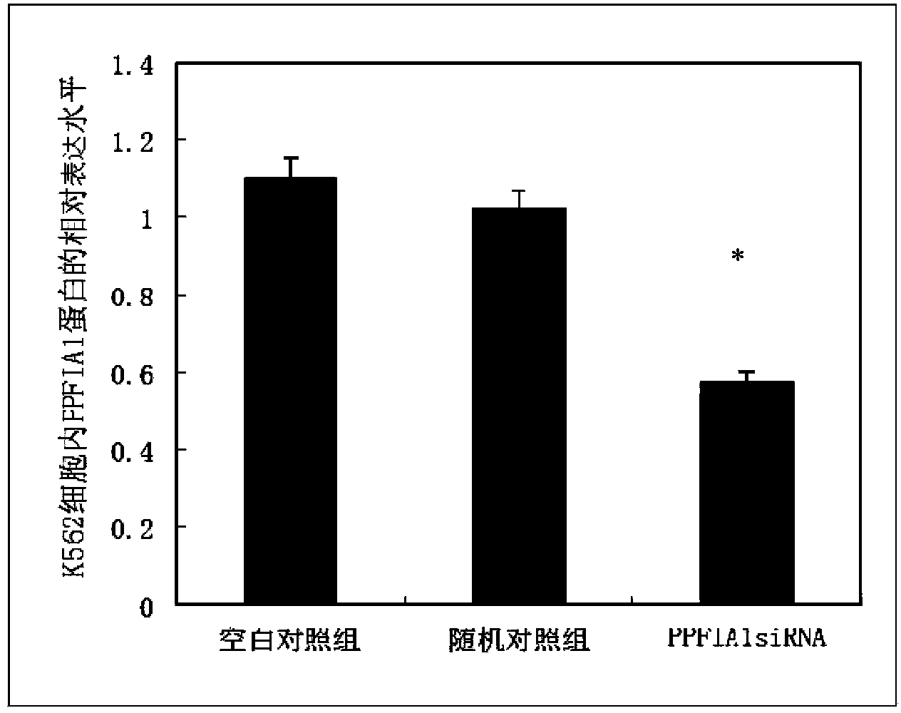 SiRNA inhibiting PPFIA1 gene expression, and its application