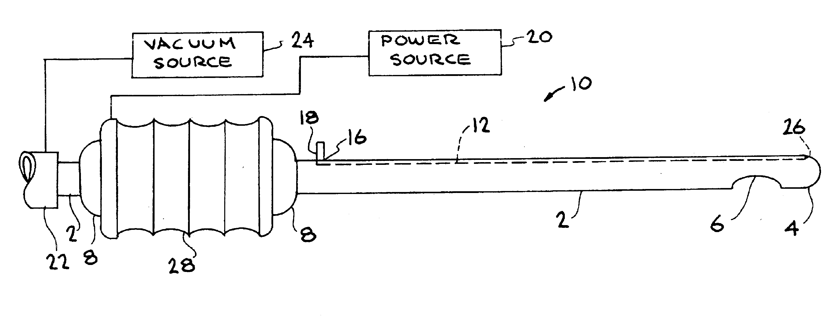 Liposuction cannula device and method