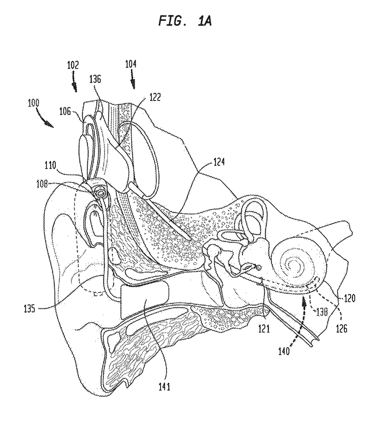 Perception change-based adjustments in hearing prostheses