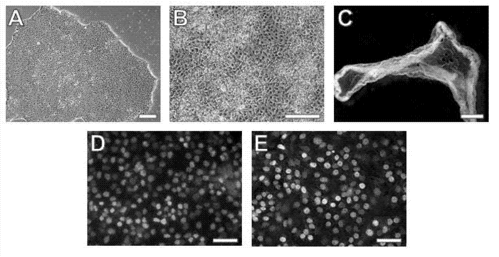 Culture medium and application thereof