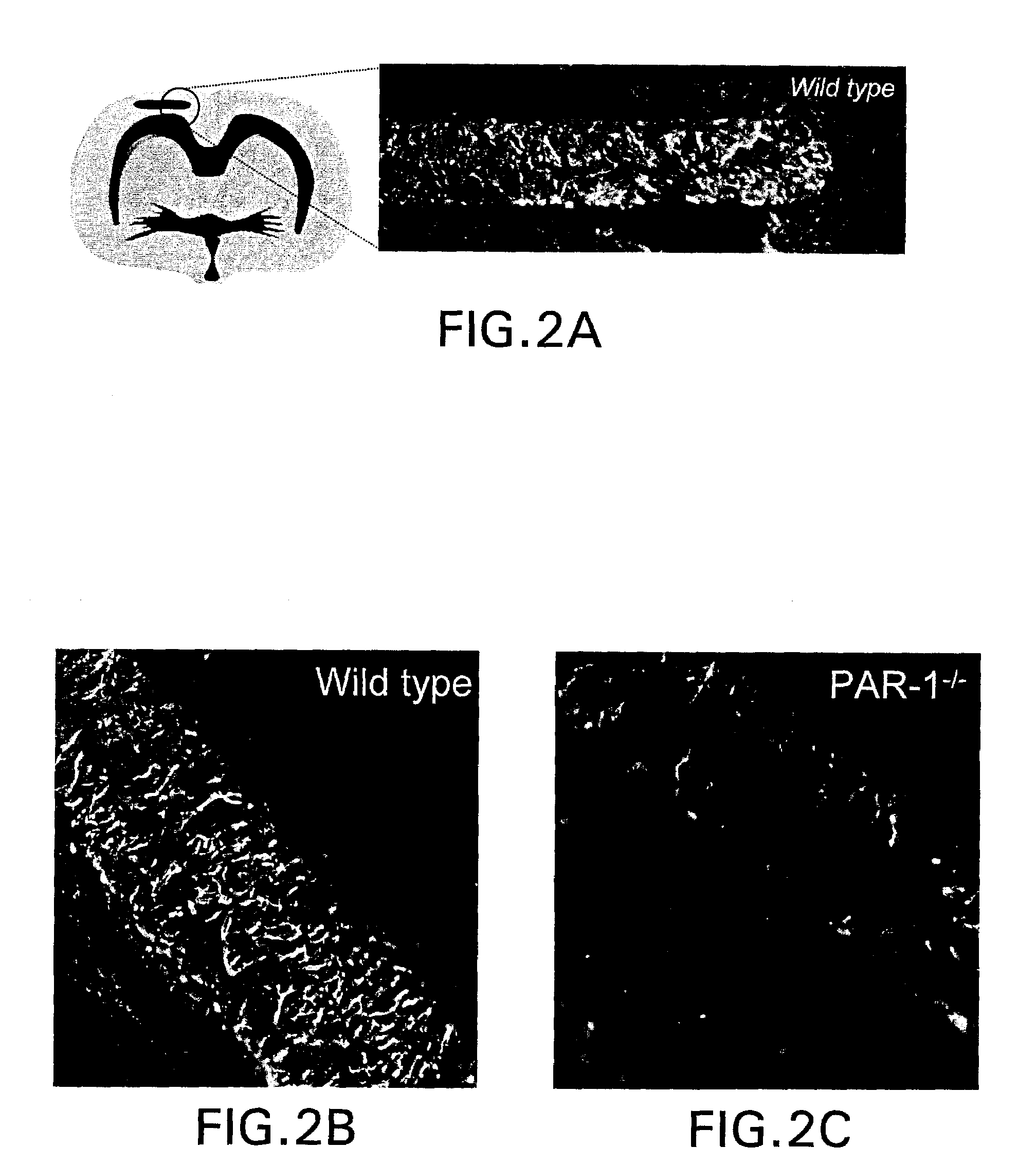 Treatment of neurodegenerative diseases and conditions using par1 antagonists