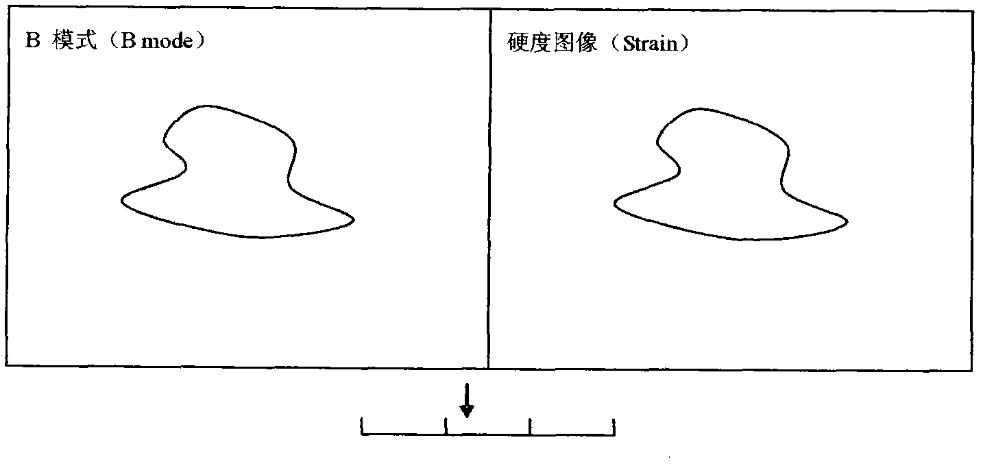 Ultrasonic elastography and pressure feedback method based on receive-side spatial-compounding