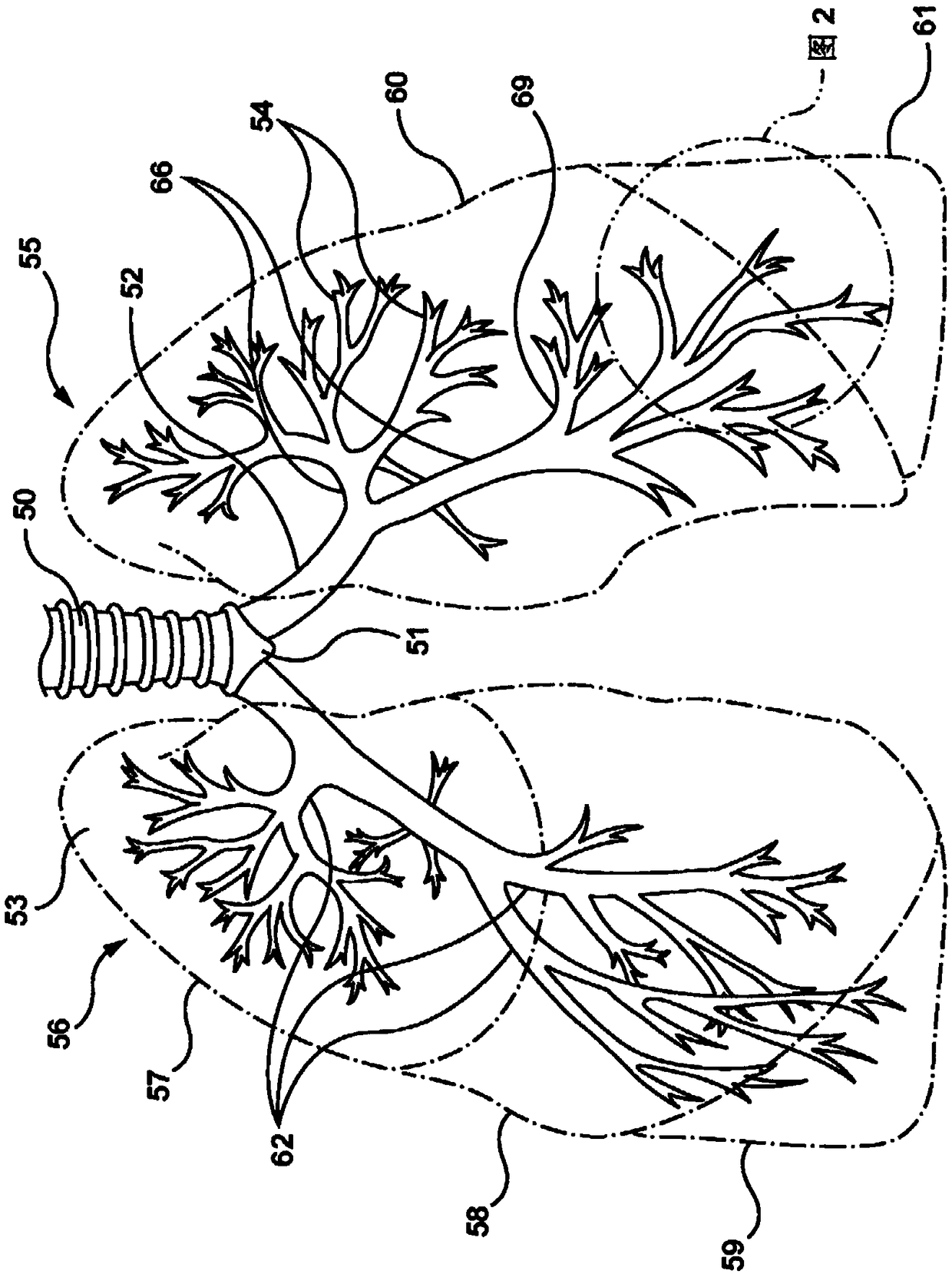 Devices and methods for treating lung tumors