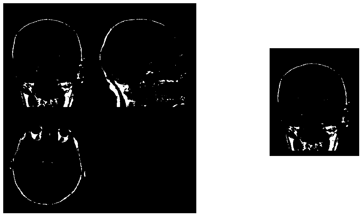 An Alzheimer's disease region detection method based on a convolutional neural network