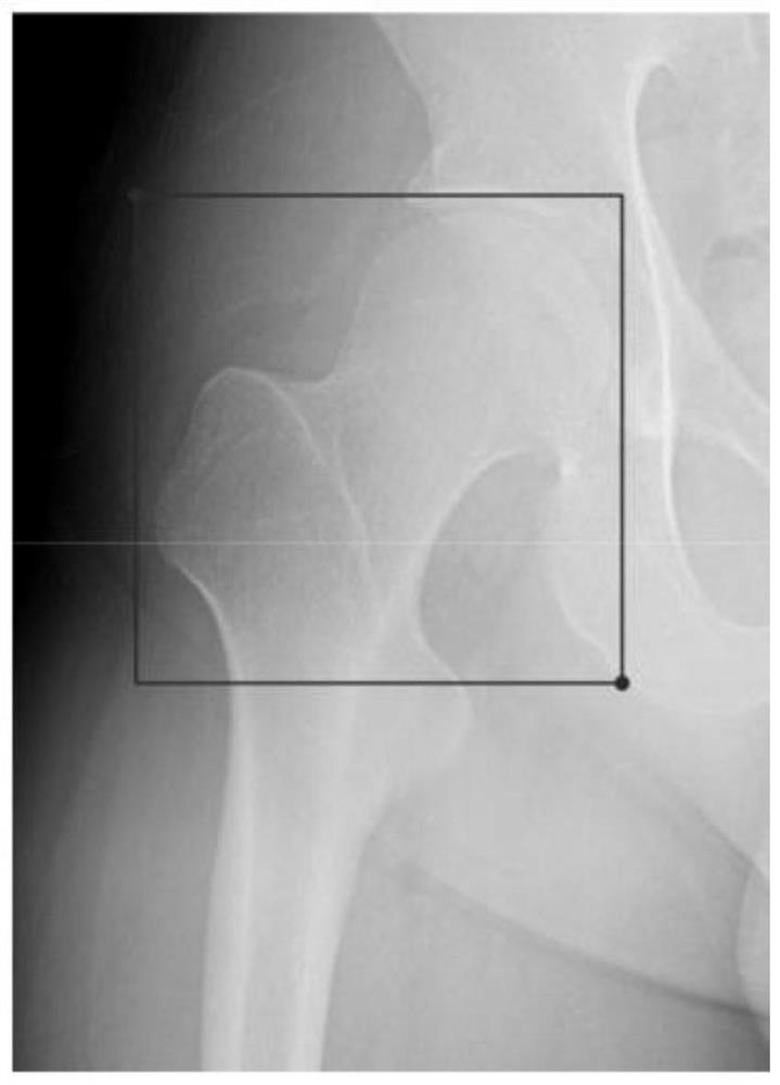 Automatic analysis method for shape of deformed long bone