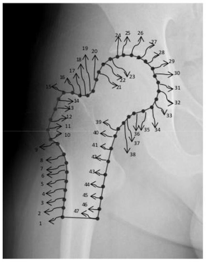 Automatic analysis method for shape of deformed long bone