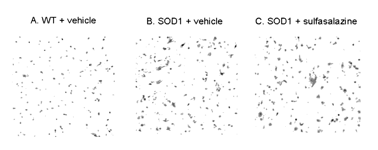 Compositions and methods for the treatment of neurodegenerative and other diseases