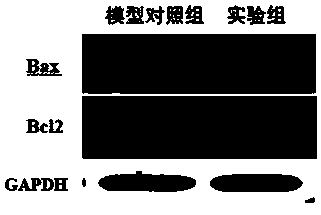 Stem cell exosome composite preparation for improving premature ovarian failure and application of composite preparation