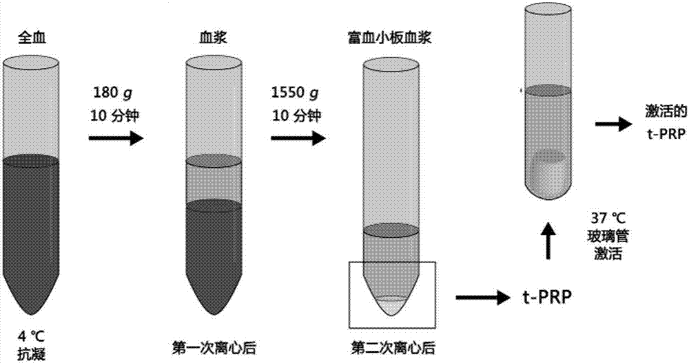 Rich-blood-platelet plasma preparation method without exogenous additives