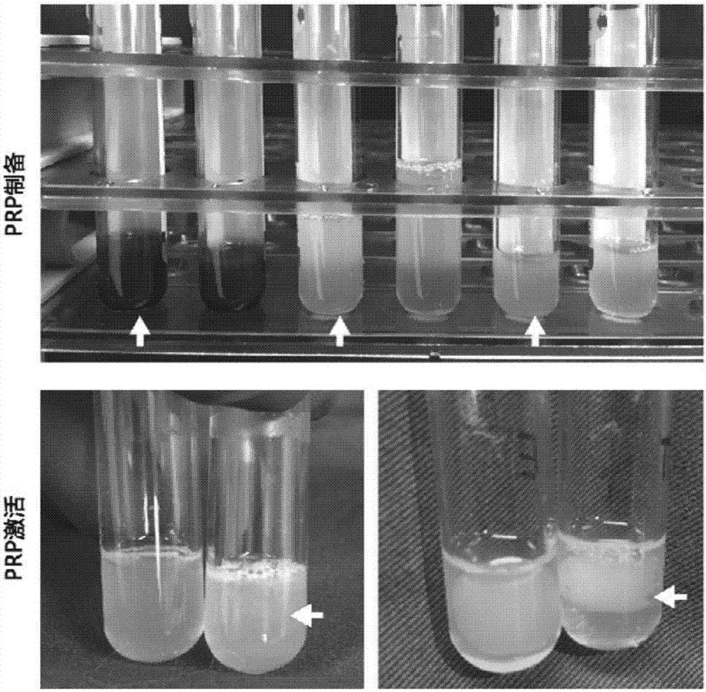 Rich-blood-platelet plasma preparation method without exogenous additives