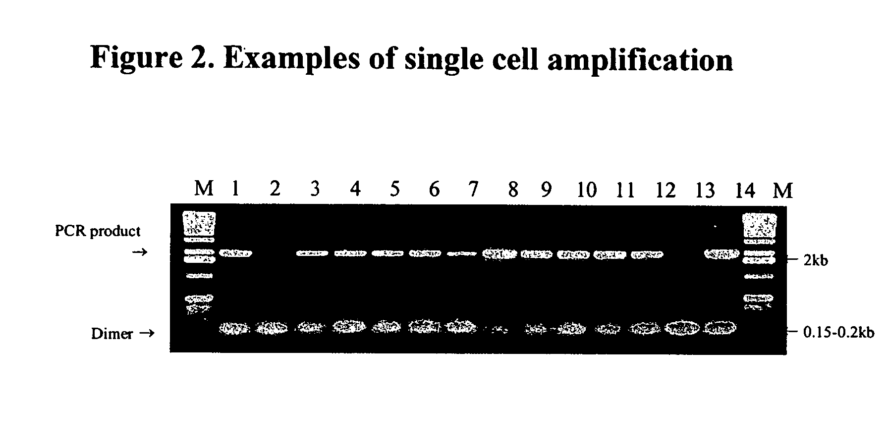 Measurement of mutation load using the p53 gene in human cells from paraffin embedded tissues