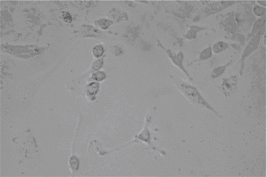 Traditional Chinese medicine compound preparation for treating liver cancer and production method thereof