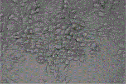 Traditional Chinese medicine compound preparation for treating liver cancer and production method thereof