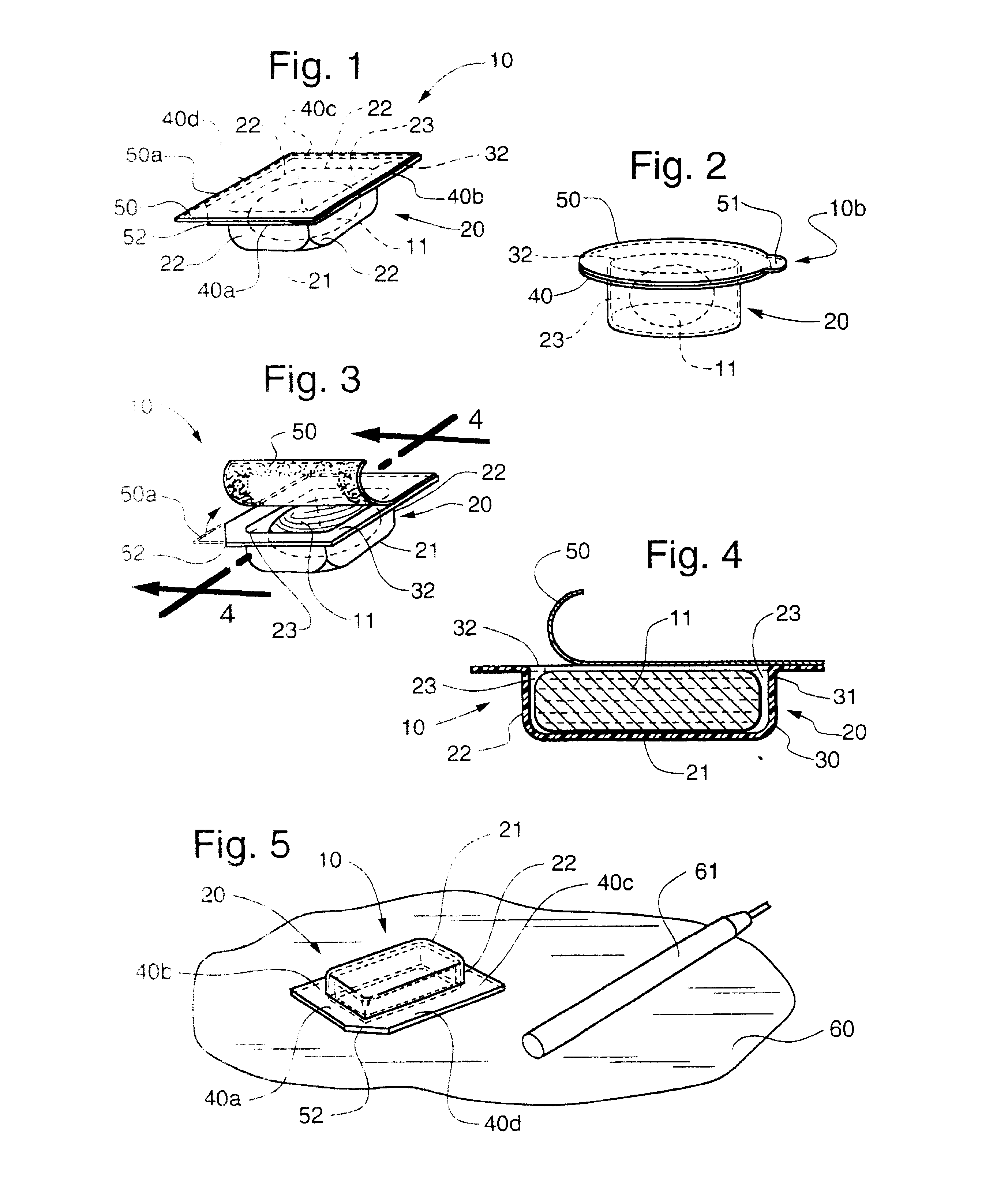 Dental composite restorative material and method of restroring a tooth