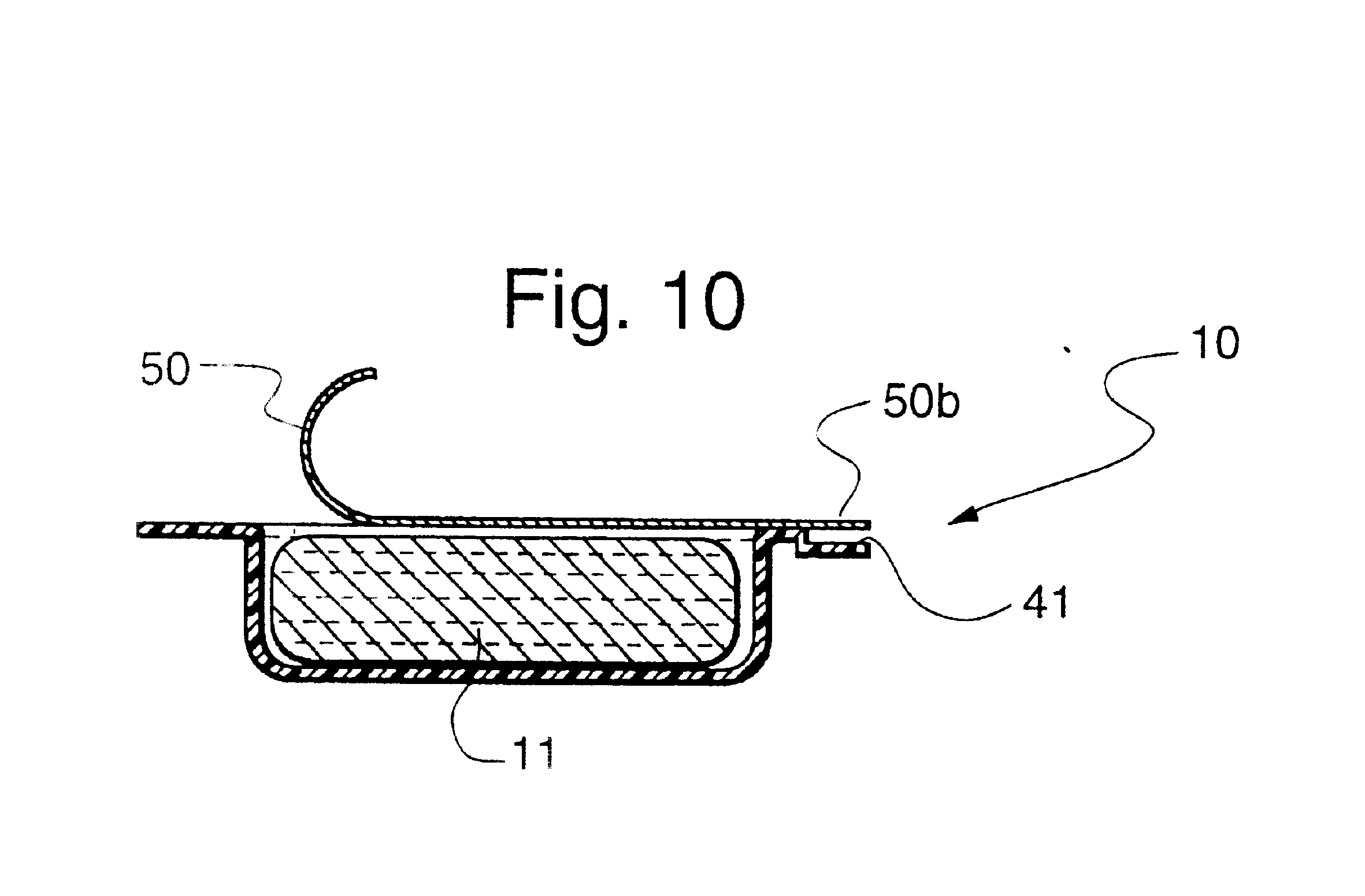 Dental composite restorative material and method of restroring a tooth