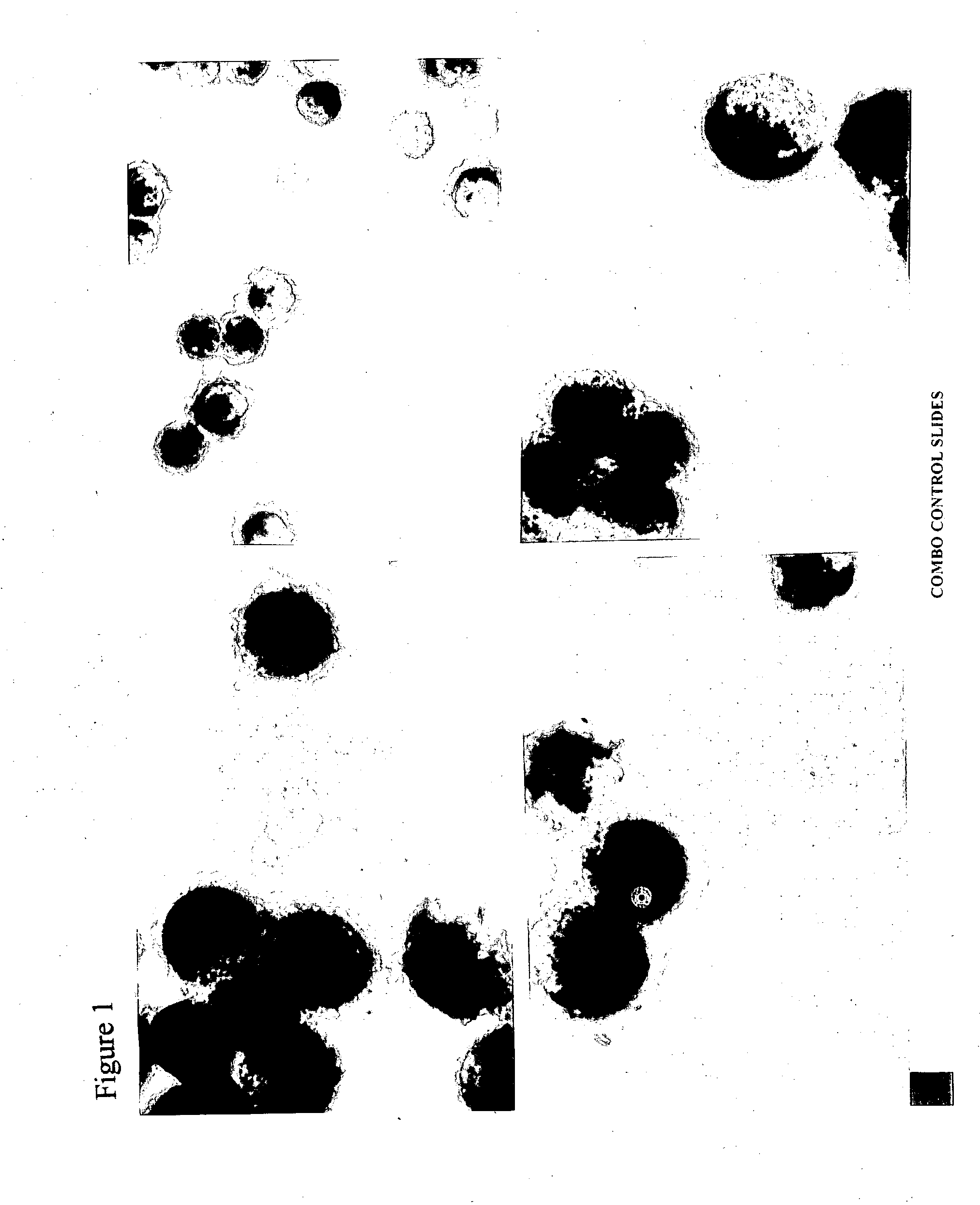 Cervical acid phosphatase - papanicolaou (CAP-PAP) test kit, method and accesories, processes for producing and using the same