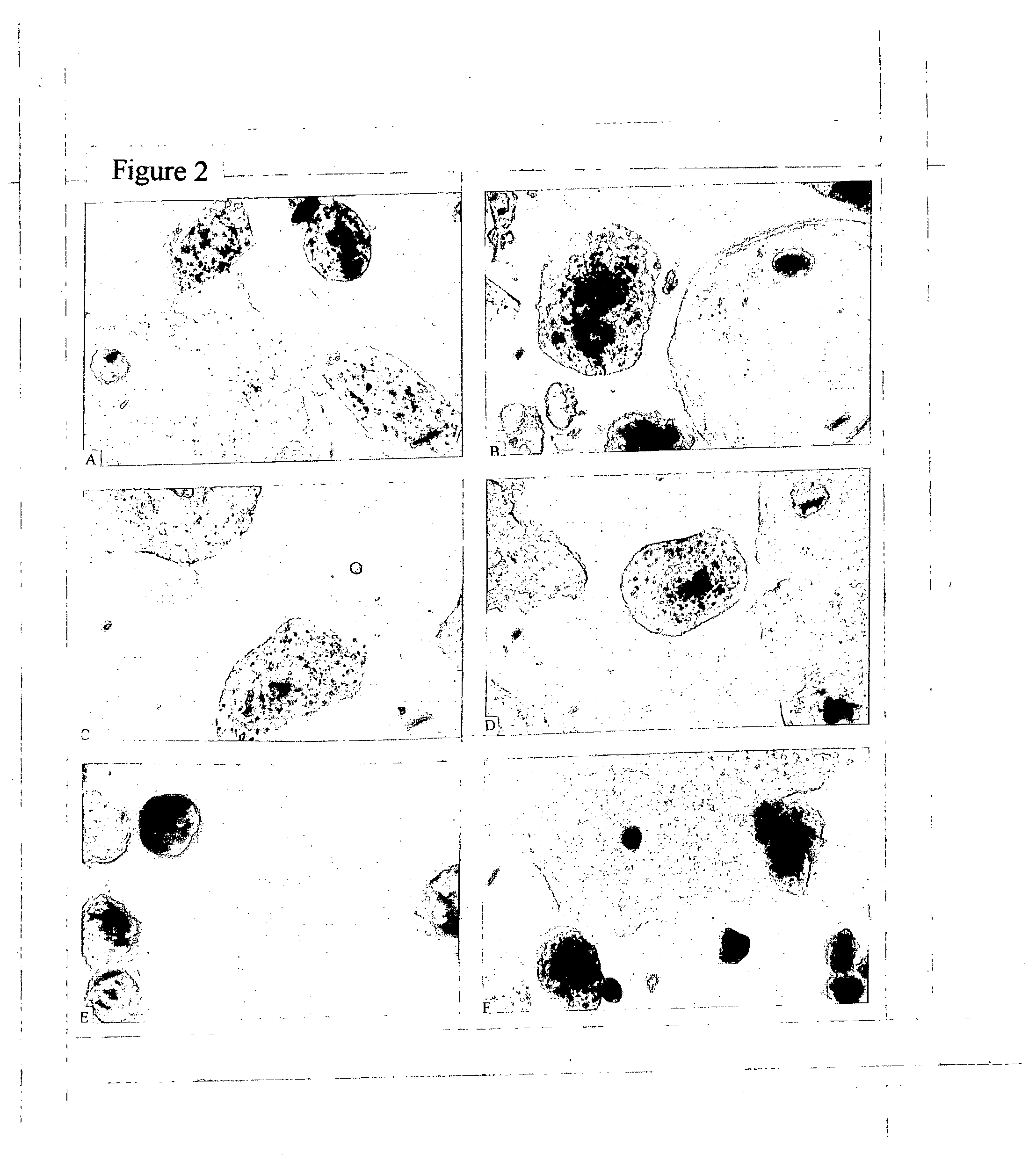 Cervical acid phosphatase - papanicolaou (CAP-PAP) test kit, method and accesories, processes for producing and using the same