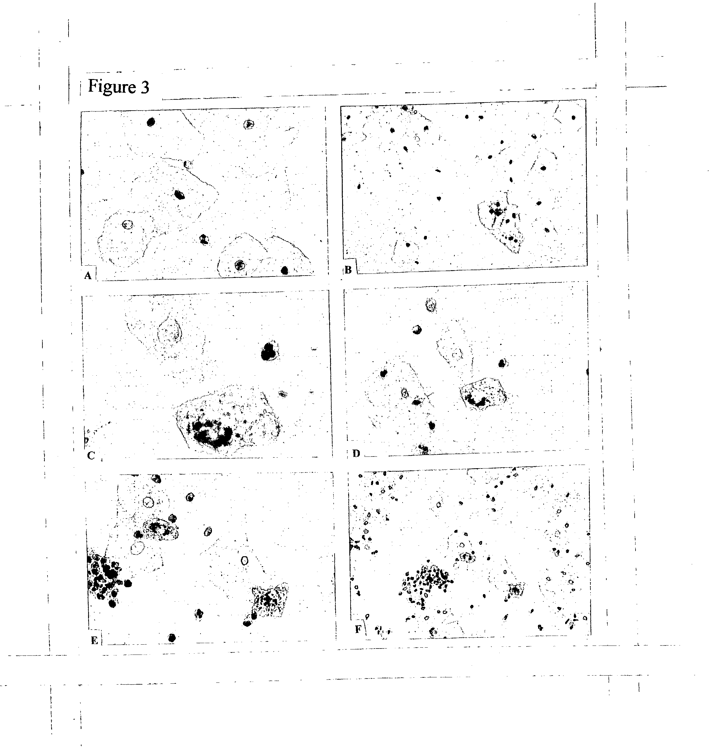 Cervical acid phosphatase - papanicolaou (CAP-PAP) test kit, method and accesories, processes for producing and using the same