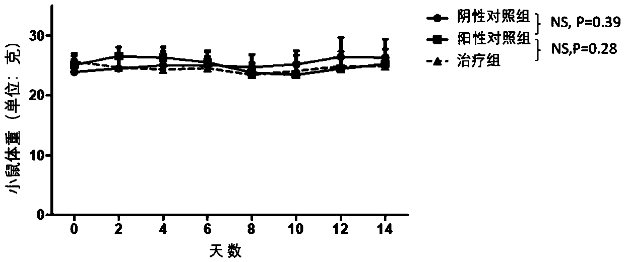 Application of CDK7 inhibitor in preparing drug for ulcerative colitis or colon cancer