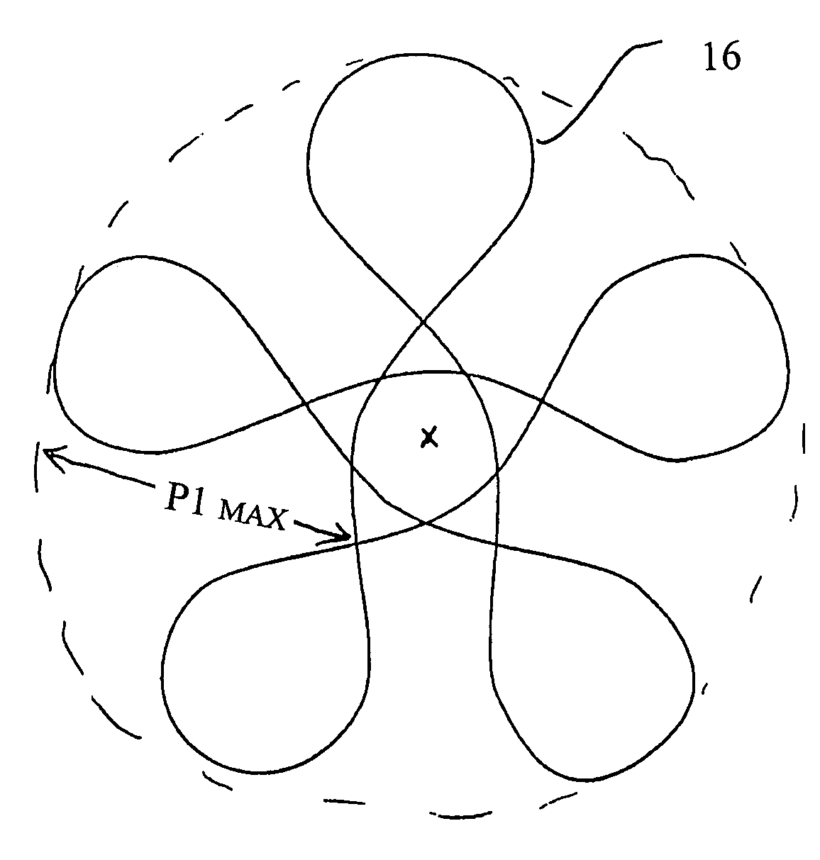 Intravascular filter