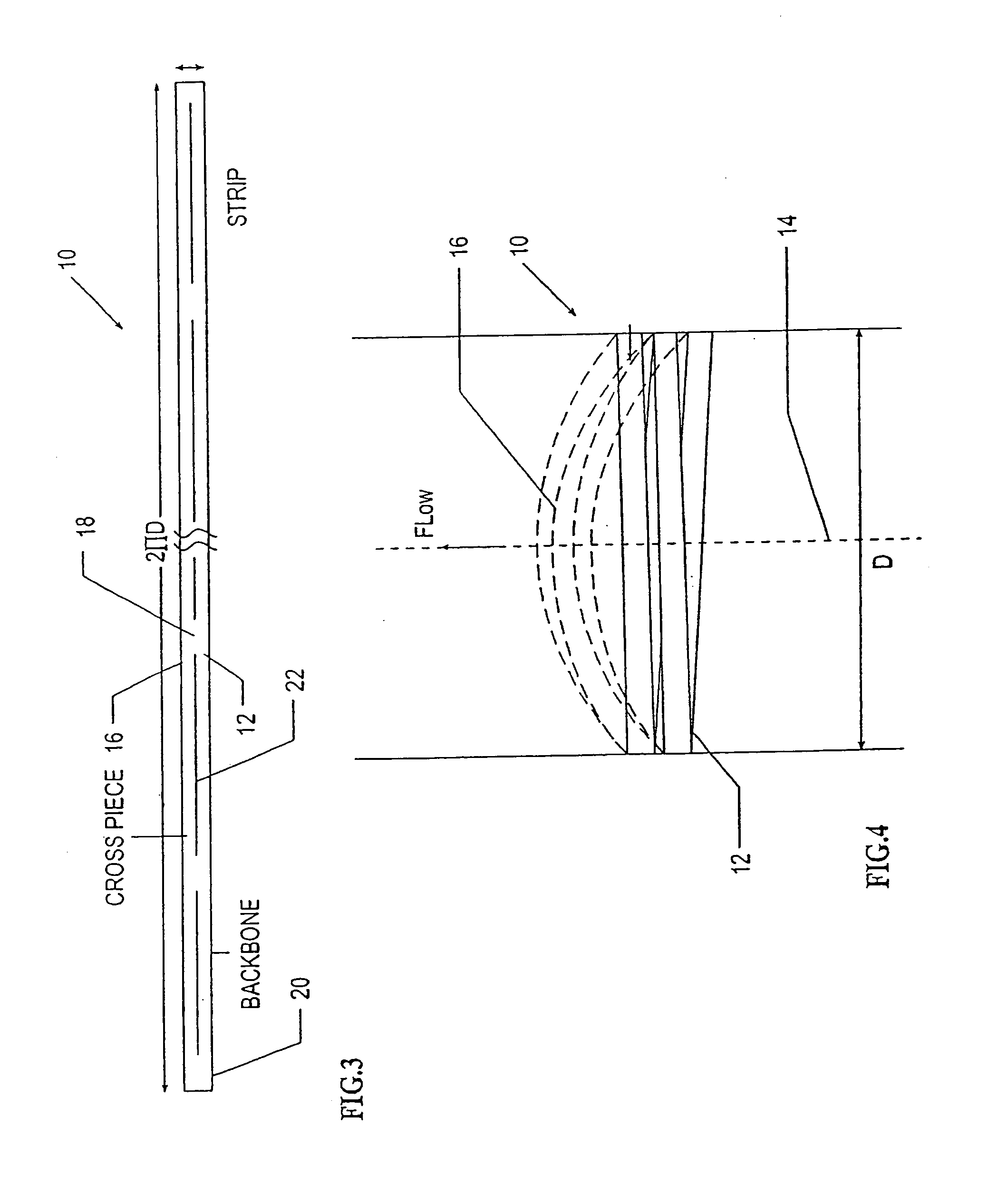 Intravascular filter