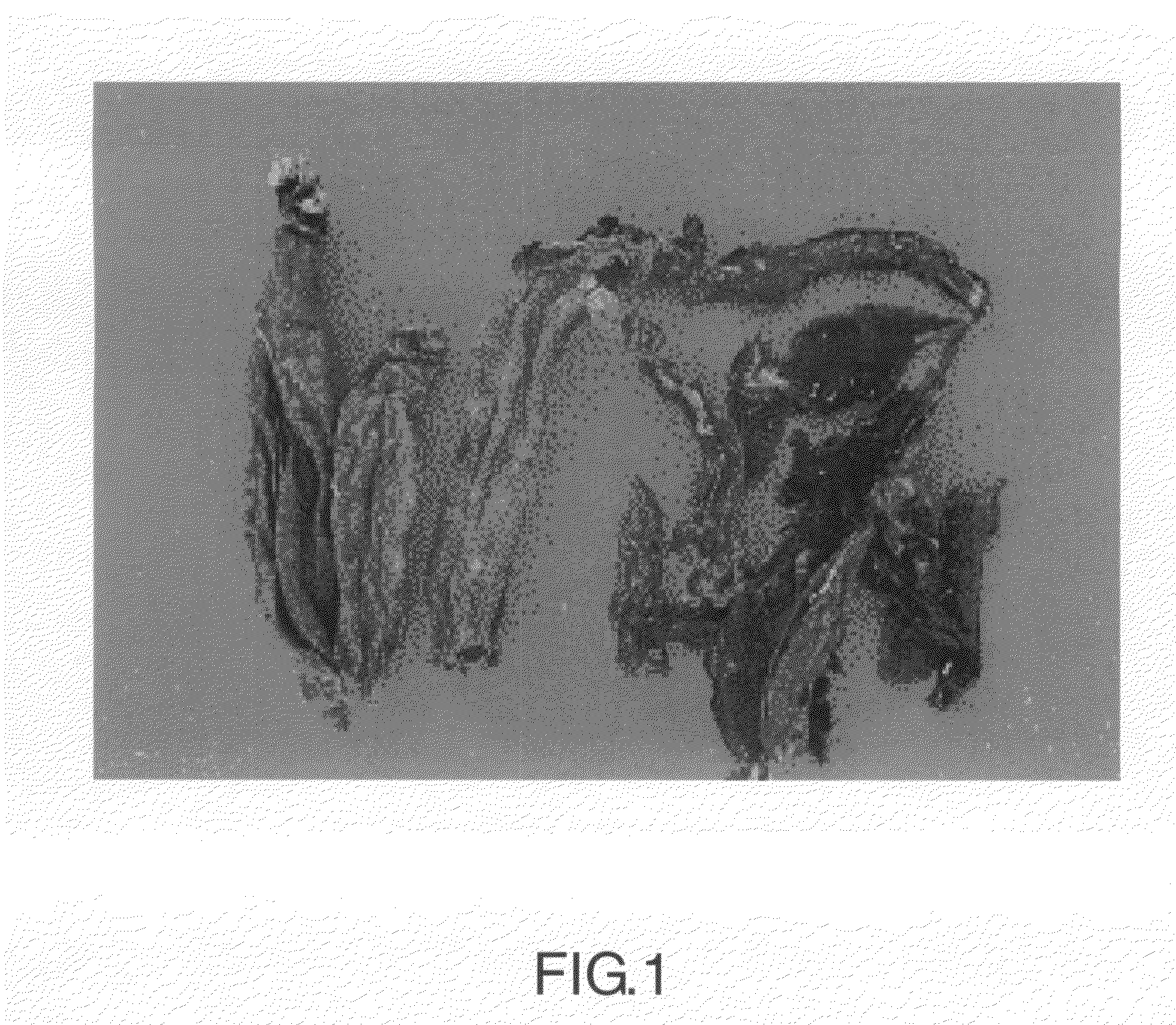 Pharmaceutical composition for treating parotid gland tumor, cerebroma and renal cyst