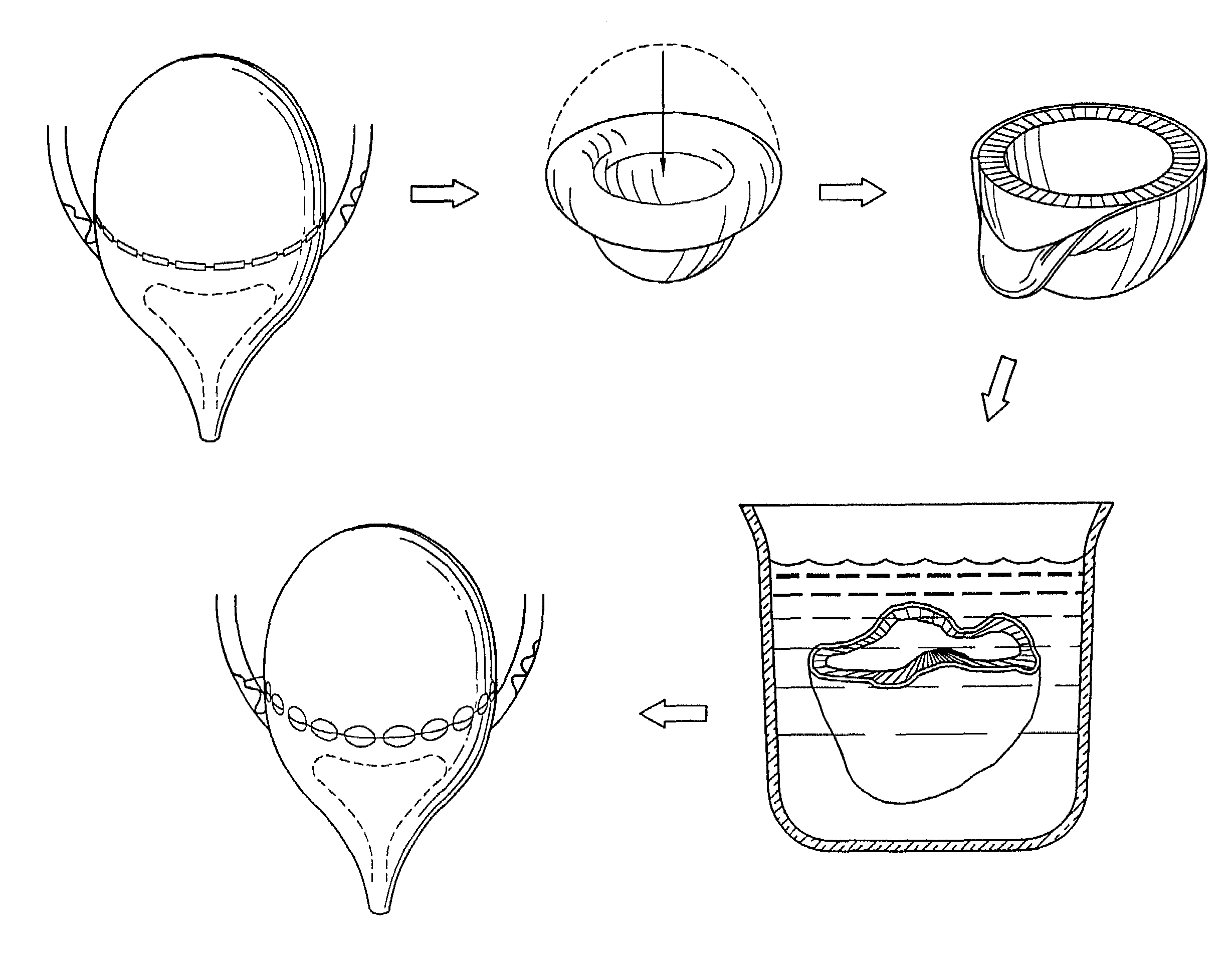 Acellular matrix grafts of collagen and elastic fiber