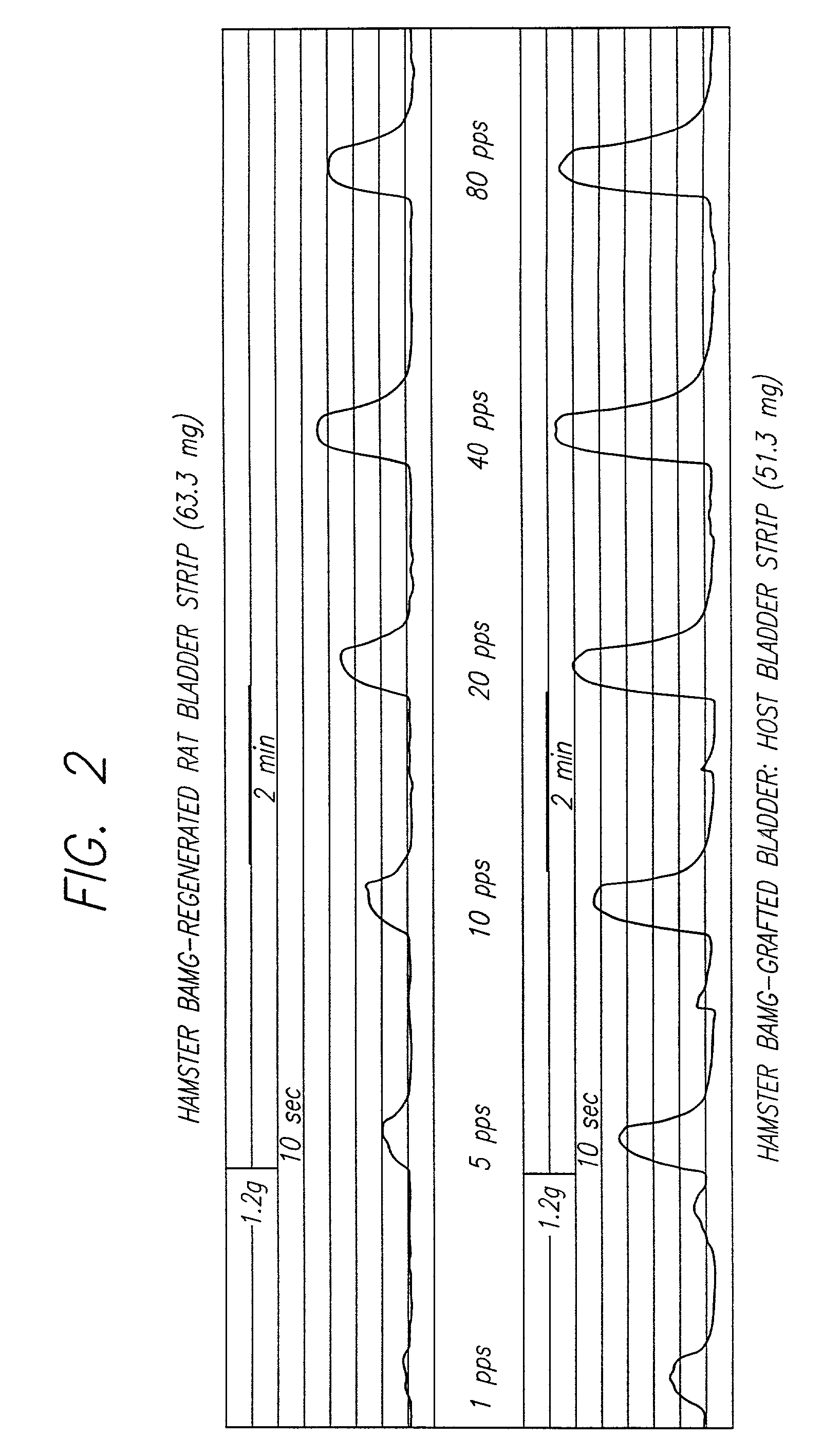 Acellular matrix grafts of collagen and elastic fiber