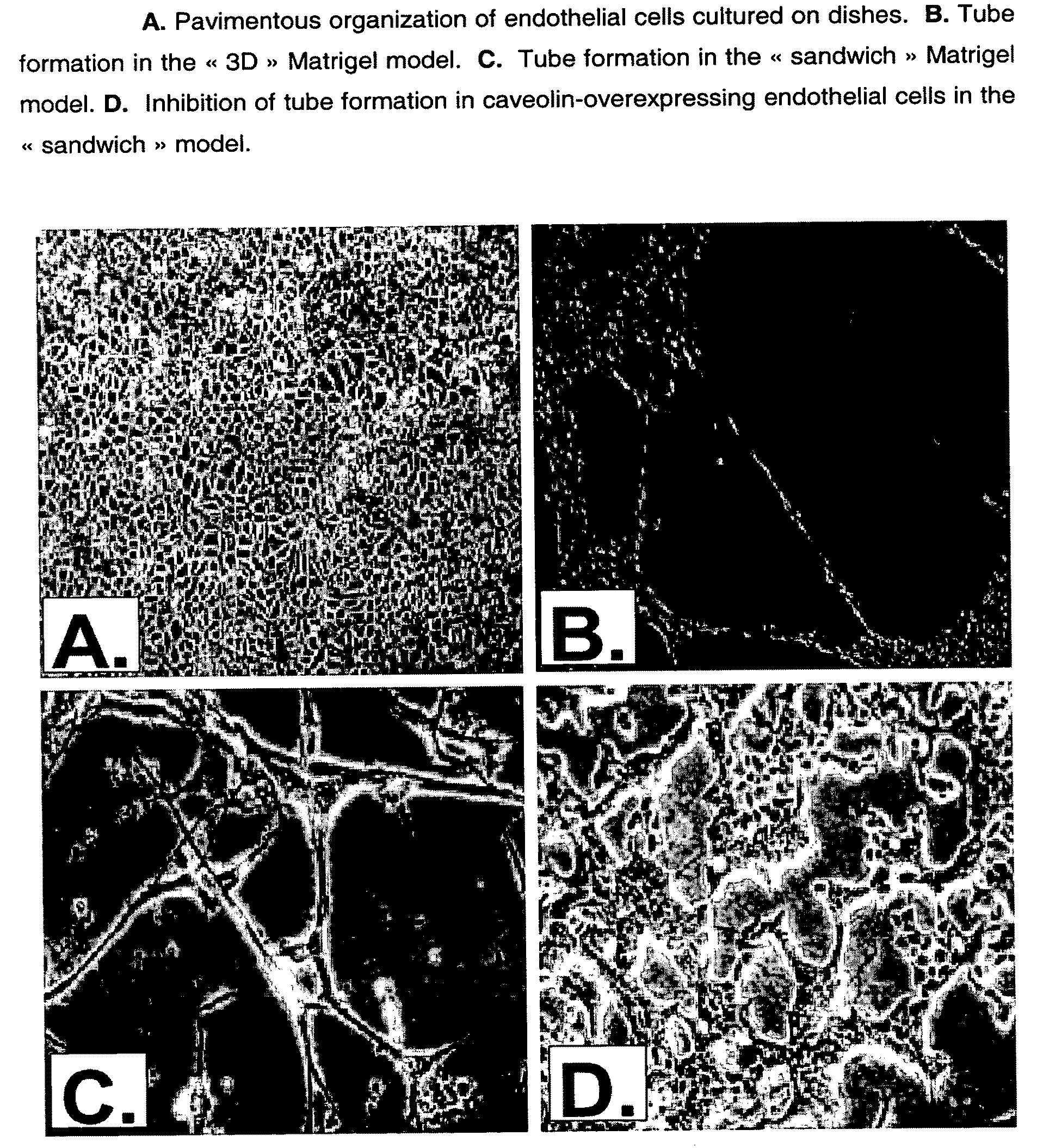 Novel pharmaceutical compositions for modulating angiogenesis