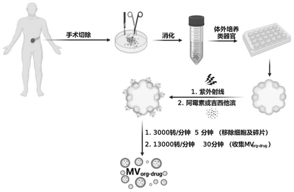 Method for entrapment of chemotherapeutic drug by using autologous organoid-derived microvesicles of tumor patient and application of chemotherapeutic drug