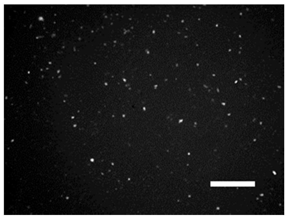 Method for entrapment of chemotherapeutic drug by using autologous organoid-derived microvesicles of tumor patient and application of chemotherapeutic drug