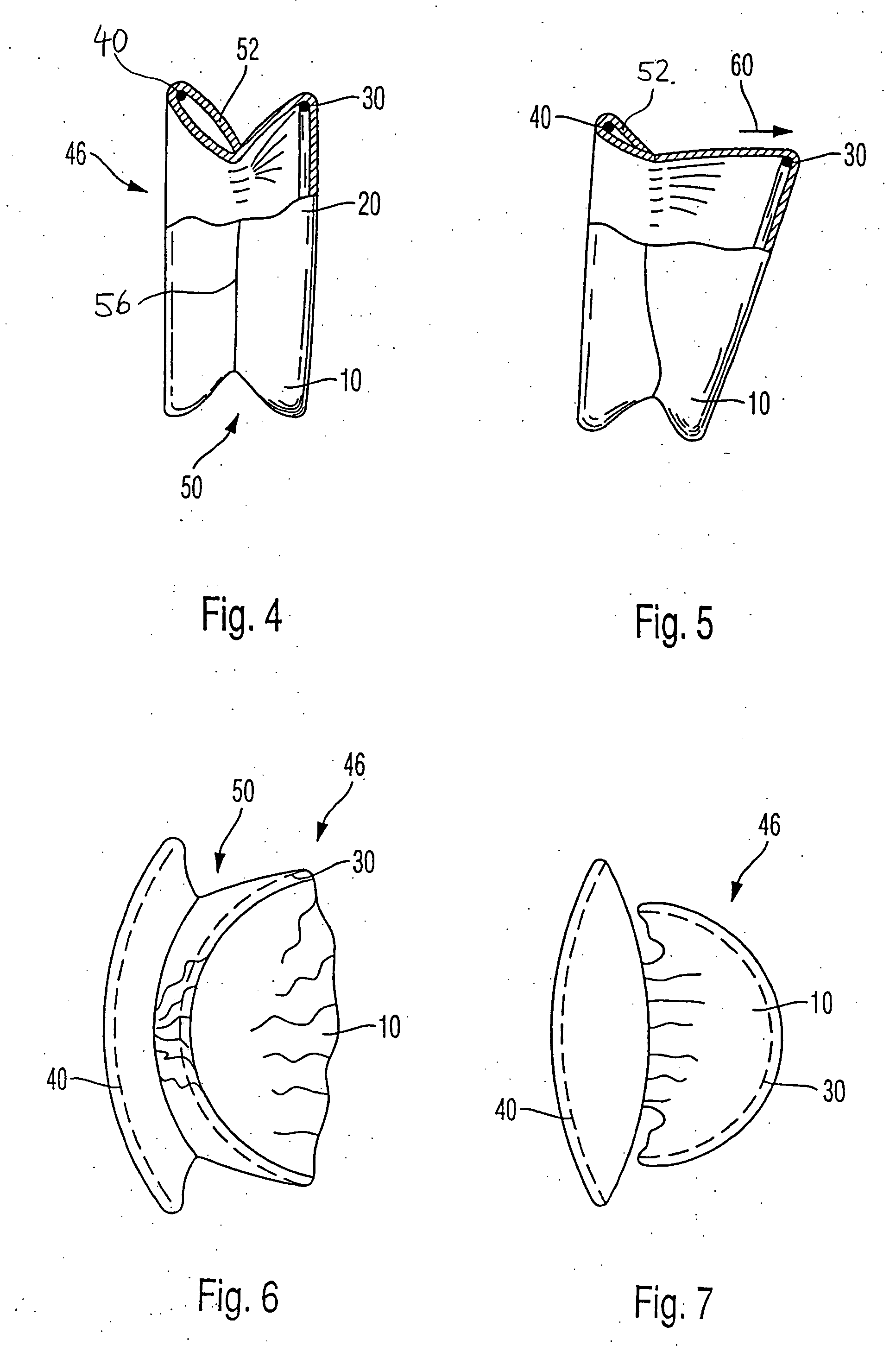 Cover and holdback element for permitting disturbance-free dental operations to be performed on teeth