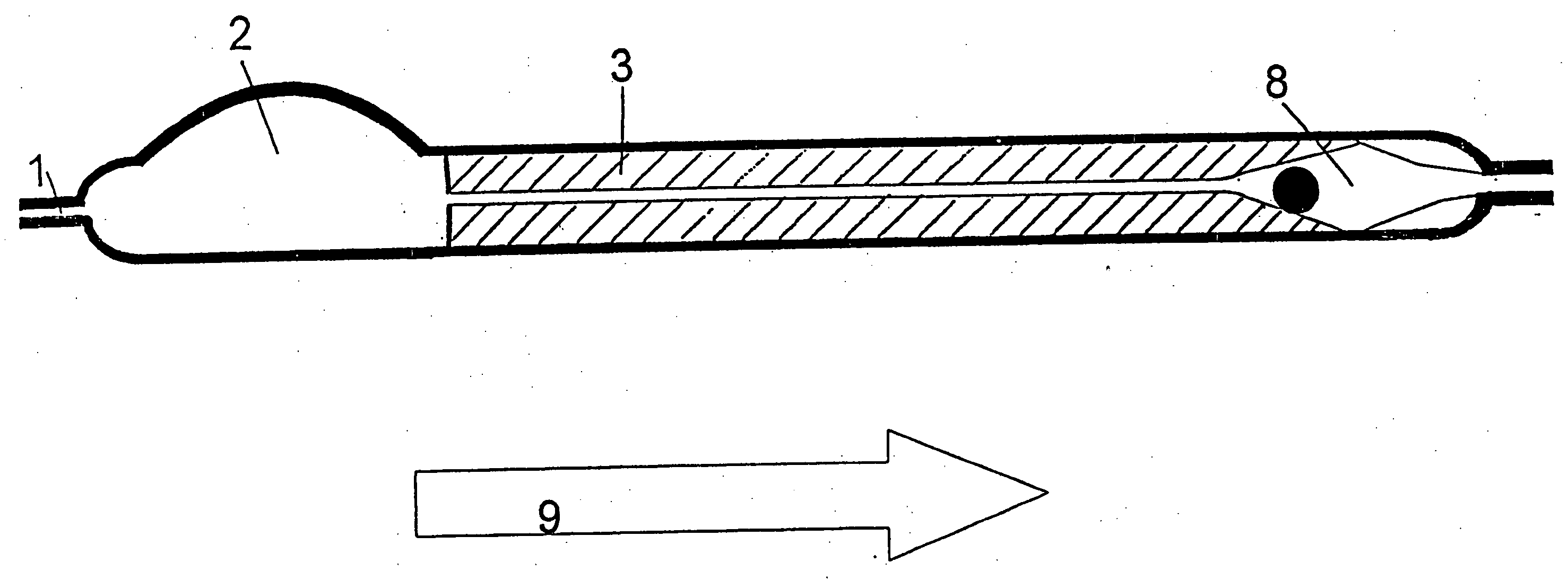 Device for the treatment of hydrocephalus