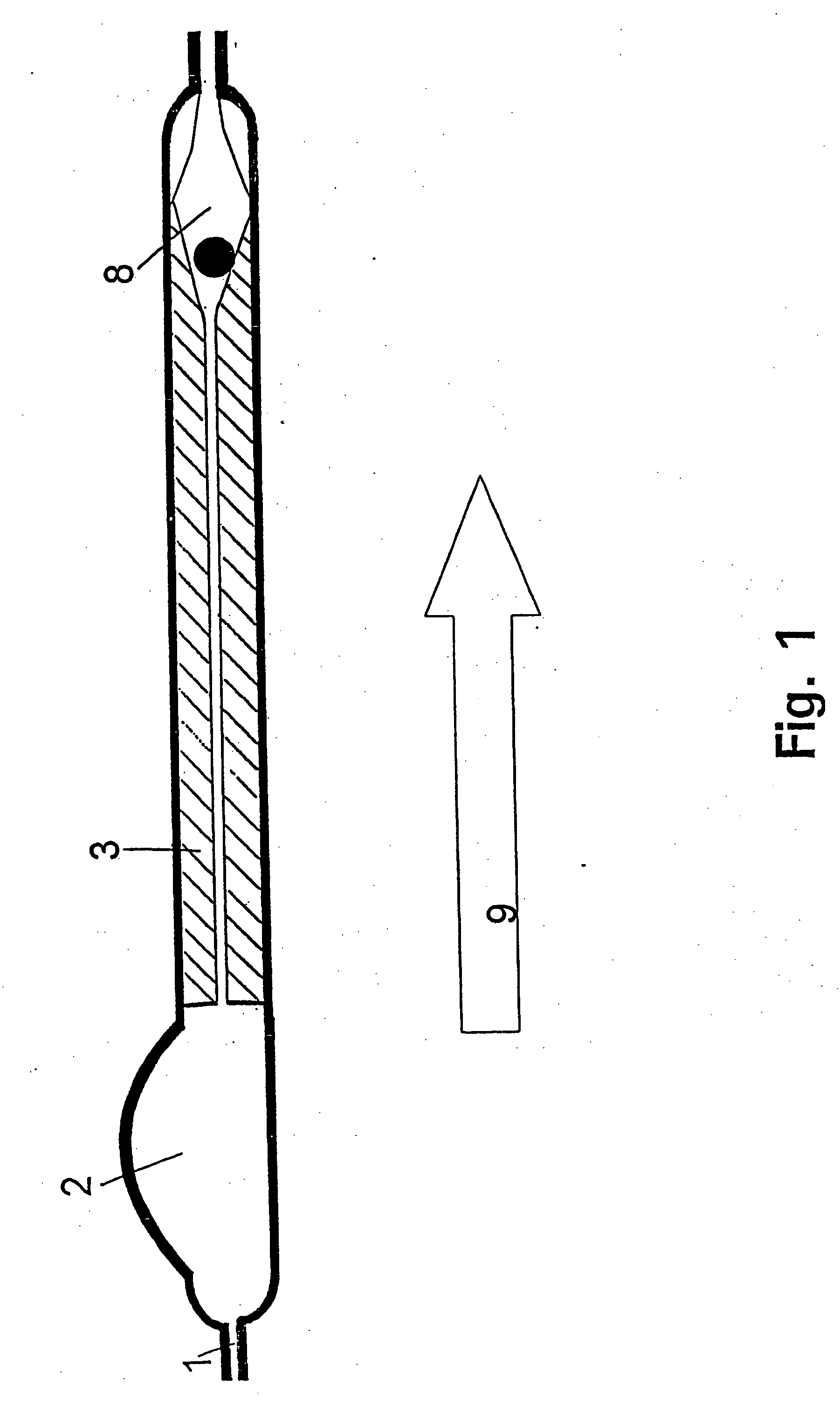 Device for the treatment of hydrocephalus