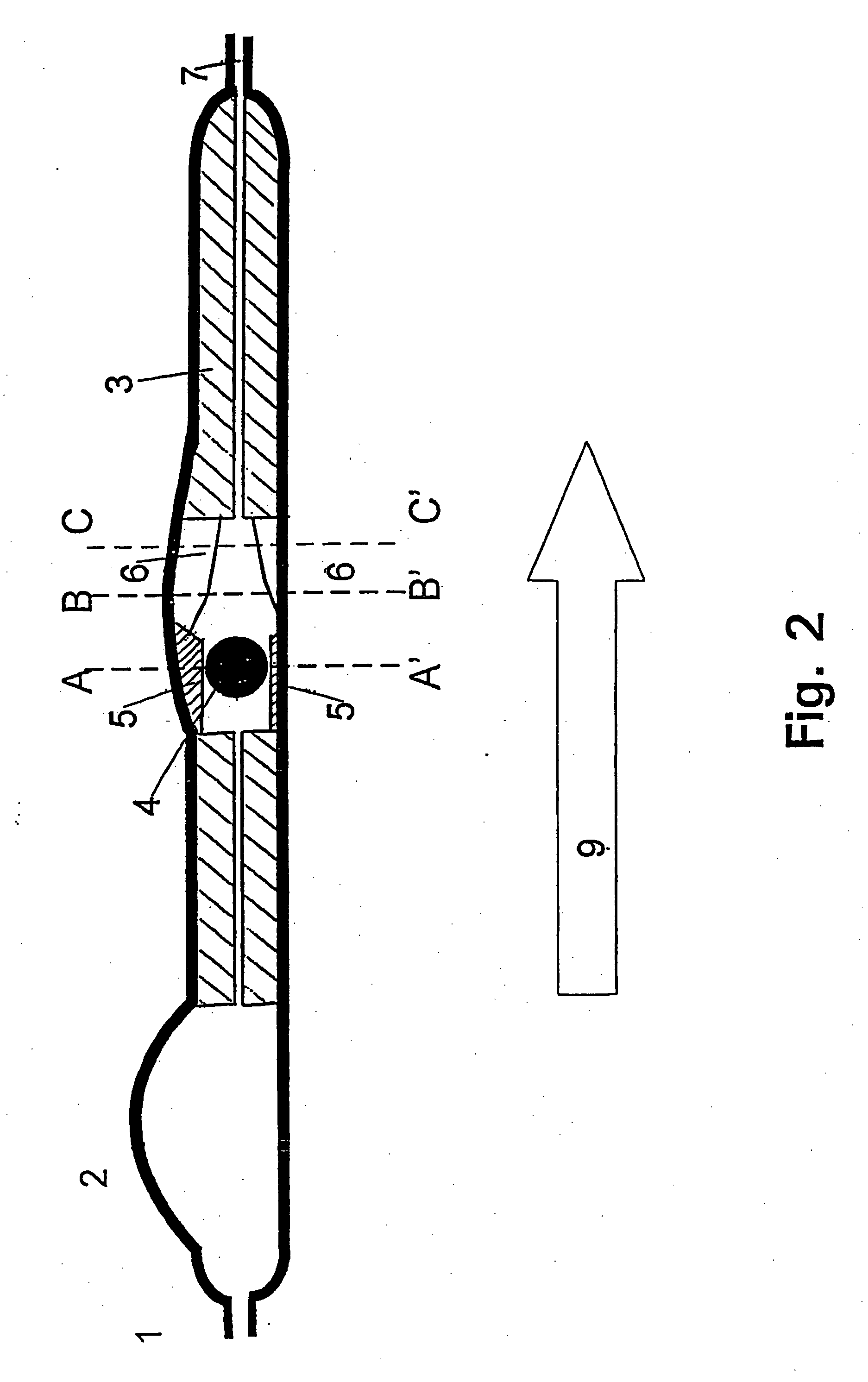 Device for the treatment of hydrocephalus